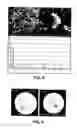 Fig. 04 - COMPOSITE BONE CEMENTS WITH A PMMA MATRIX, CONTAINING BIOACTIVE ANTIBACTERIAL GLASSES OR GLASSCERAMICS