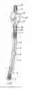 Fig. 01 -  DEVICE FOR PREVENTING INCONTINENCE