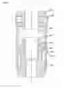 Fig. 15 -  DEVICE FOR PREVENTING INCONTINENCE