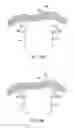 Fig. 16 - APPARATUS AND METHOD FOR INTRA-ABDOMINALLY MOVING A FIRST INTERNAL ORGAN TO A POSITION AWAY FROM A SECOND INTERNAL ORGAN AND THEN HOLDING THE FIRST INTERNAL ORGAN IN THE POSITION WITHOUT MANUAL INPUT
