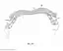Fig. 17 - APPARATUS AND METHOD FOR INTRA-ABDOMINALLY MOVING A FIRST INTERNAL ORGAN TO A POSITION AWAY FROM A SECOND INTERNAL ORGAN AND THEN HOLDING THE FIRST INTERNAL ORGAN IN THE POSITION WITHOUT MANUAL INPUT