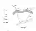 Fig. 19 - APPARATUS AND METHOD FOR INTRA-ABDOMINALLY MOVING A FIRST INTERNAL ORGAN TO A POSITION AWAY FROM A SECOND INTERNAL ORGAN AND THEN HOLDING THE FIRST INTERNAL ORGAN IN THE POSITION WITHOUT MANUAL INPUT