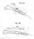 Fig. 05 - Self-anchoring sling and introducer system