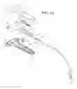 Fig. 06 - Self-anchoring sling and introducer system