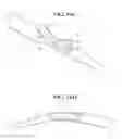 Fig. 19 - Self-anchoring sling and introducer system