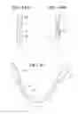 Fig. 37 - Self-anchoring sling and introducer system