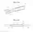 Fig. 41 - Self-anchoring sling and introducer system