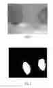 Fig. 07 - METHOD AND APPARATUS FOR AUTOMATIC VERIFICATION OF ENDOTRACHEAL INTUBATION