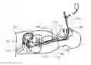 Fig. 01 - Optically guided medical tube and control unit assembly and methods of use
