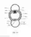 Fig. 10 - Optically guided medical tube and control unit assembly and methods of use