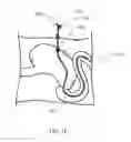 Fig. 17 - Optically guided medical tube and control unit assembly and methods of use
