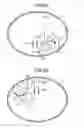 Fig. 05 - CAPSULE MEDICAL DEVICE GUIDANCE SYSTEM