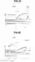 Fig. 40 - Two-part bending endoscope