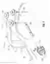 Fig. 07 - Suspension system for minimally invasive surgery