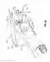 Fig. 09 - Suspension system for minimally invasive surgery