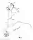 Fig. 10 - Suspension system for minimally invasive surgery