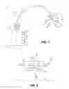 Fig. 02 - Apparatuses and methods for supporting an umbilicus