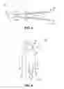 Fig. 03 - Apparatuses and methods for supporting an umbilicus