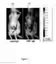 Fig. 02 - Intra-operative molecular imaging