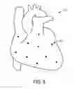 Fig. 08 - Apparatus, method and computer program for determining a property of a heart
