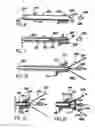 Fig. 04 - BREAST SURGERY METHOD AND APPARATUS