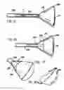 Fig. 06 - BREAST SURGERY METHOD AND APPARATUS