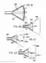 Fig. 07 - BREAST SURGERY METHOD AND APPARATUS
