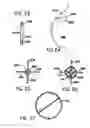 Fig. 08 - BREAST SURGERY METHOD AND APPARATUS