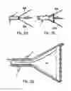 Fig. 09 - BREAST SURGERY METHOD AND APPARATUS