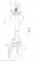 Fig. 05 - Surgical instrument with motorized attachment feature