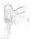 Fig. 06 - Surgical instrument with motorized attachment feature