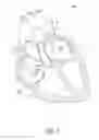 Fig. 02 - Occlusion apparatus
