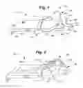 Fig. 02 - COOPERATING DEFIBRILLATORS AND EXTERNAL CHEST COMPRESSION DEVICES