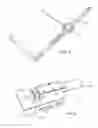 Fig. 07 - EXPANSIBLE DEVICE OF MEDICAL USE FOR SPECIFIC COMPRESSION OF THORAX, SYSTEM COMPRISING IT AND METHOD FOR CORRECTING A THORACIC DEFORMITY IN A PATIENT
