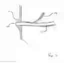 Fig. 03 - DEVICES FOR TREATING OBESITY AND METHODS OF USING THOSE DEVICES