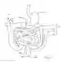 Fig. 04 - DEVICES FOR TREATING OBESITY AND METHODS OF USING THOSE DEVICES