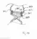 Fig. 12 - DEVICES FOR TREATING OBESITY AND METHODS OF USING THOSE DEVICES