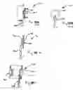 Fig. 27 - DEVICES FOR TREATING OBESITY AND METHODS OF USING THOSE DEVICES