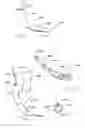 Fig. 41 - DEVICES FOR TREATING OBESITY AND METHODS OF USING THOSE DEVICES