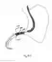 Fig. 47 - DEVICES FOR TREATING OBESITY AND METHODS OF USING THOSE DEVICES