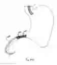 Fig. 48 - DEVICES FOR TREATING OBESITY AND METHODS OF USING THOSE DEVICES