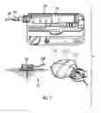 Fig. 02 - Activity guard