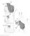 Fig. 04 - Apparatuses and methods for negative pressure wound therapy