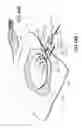 Fig. 44 - Apparatuses and methods for negative pressure wound therapy