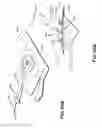 Fig. 45 - Apparatuses and methods for negative pressure wound therapy