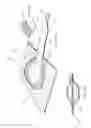 Fig. 72 - Apparatuses and methods for negative pressure wound therapy