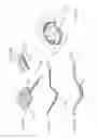 Fig. 75 - Apparatuses and methods for negative pressure wound therapy