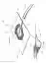 Fig. 76 - Apparatuses and methods for negative pressure wound therapy