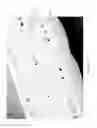 Fig. 91 - Apparatuses and methods for negative pressure wound therapy