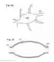 Fig. 03 - Balloon assisted occlusion of aneurysms